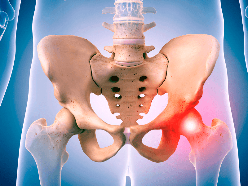 My Hip Hurts When I Sleep on My Side. What Could It Mean?: Advanced Spine  Care and Pain Management: Pain Management Physicians